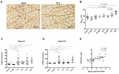 Time- and Ventricular-Specific Expression Profiles of Genes Encoding Z-Disk Proteins in Pressure Overload Model of Left Ventricular Hypertrophy